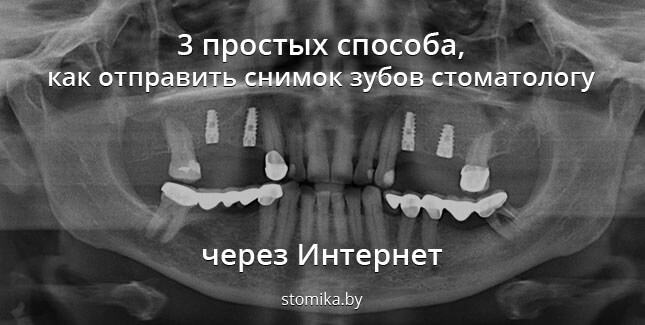 Инструкция по отправке снимков зубов стоматологу через интернет