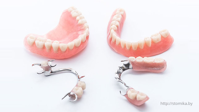 Восстановление зубов съемными протезами