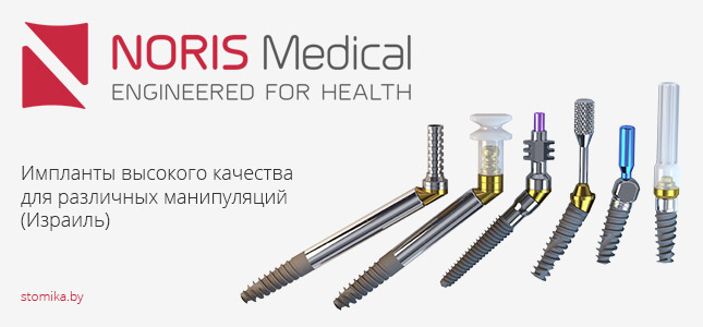 Импланты Noris Medical: виды и цены в Минске