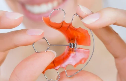 Пластинки для выравнивания зубов Томск Кубанская харизма томск стоматология отзывы